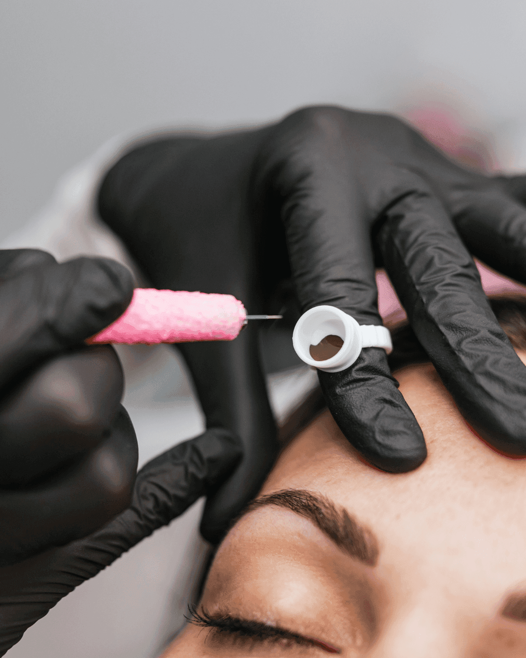 Dermal Preparation