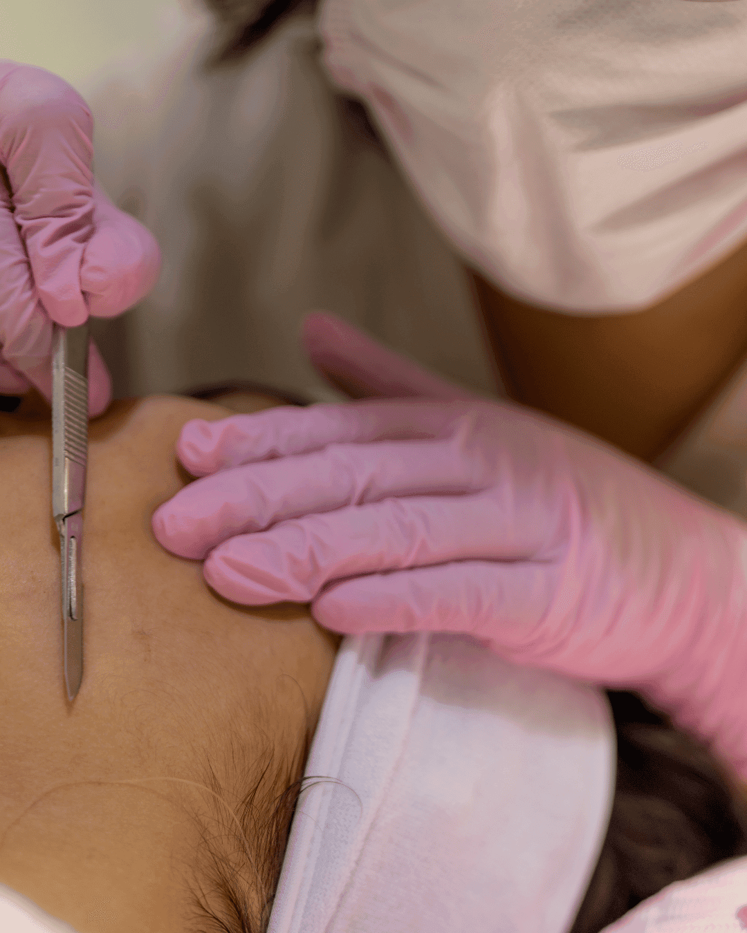 Skin Analysis & Prep