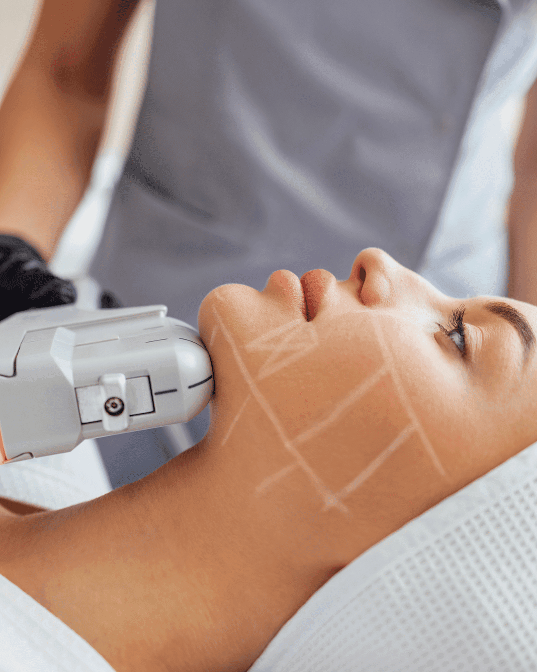Non-Surgical Facelift
