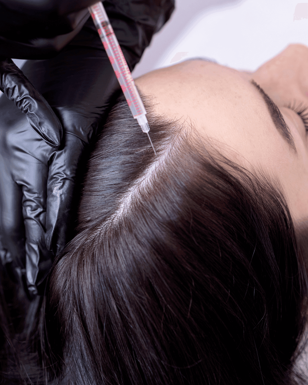 Treatment Details